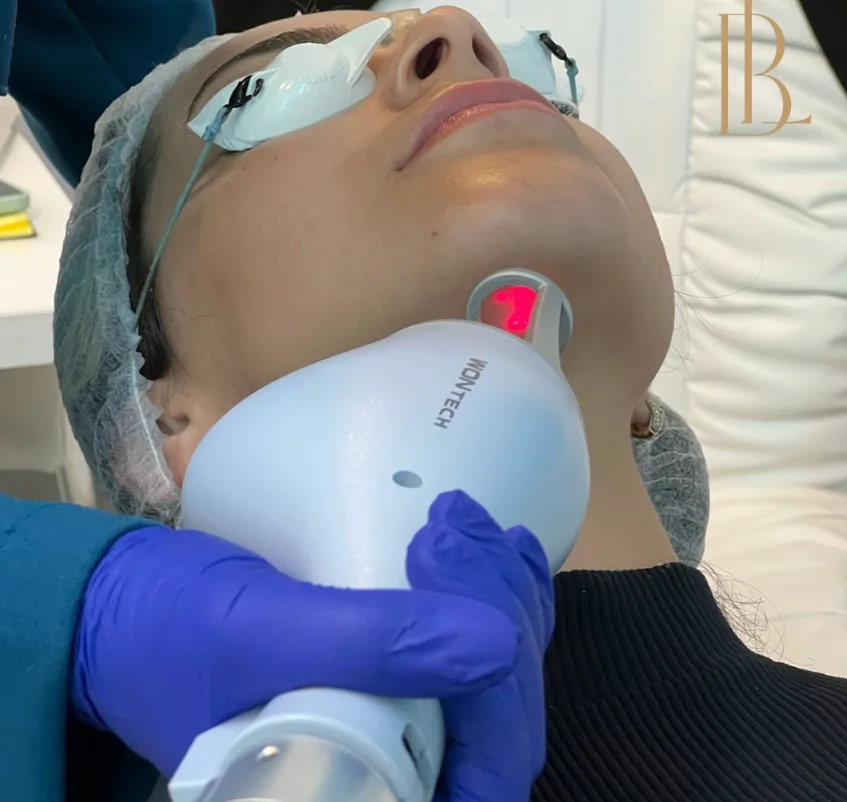 Paciente com óculos de proteção recebendo procedimento facial com aparelho de laser